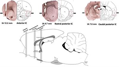 Site-Specific Regulation of Stress Responses Along the Rostrocaudal Axis of the Insular Cortex in Rats